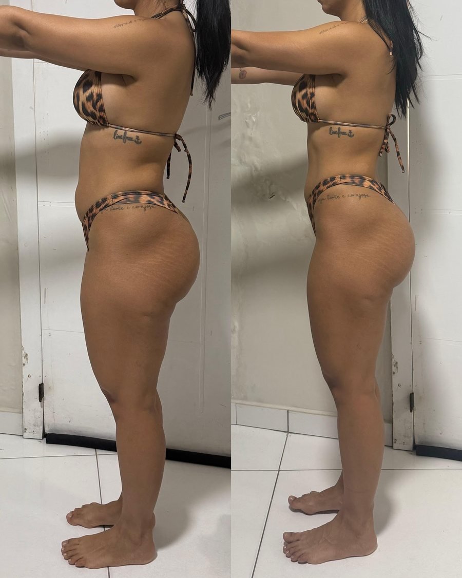 Antes e depois de aluna do Team Miletnar