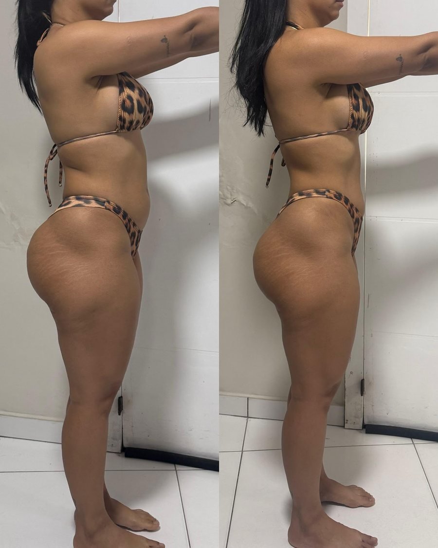 Antes e depois de aluna do Team Miletnar
